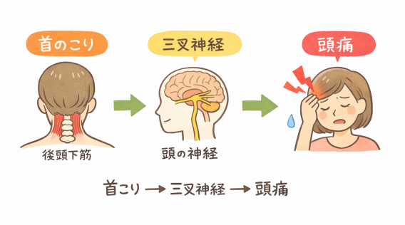 頭痛、三叉神経、首イラスト
